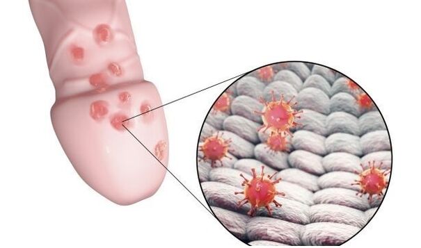 jinsiy olatni kattalashtiruvchi jelga allergiya